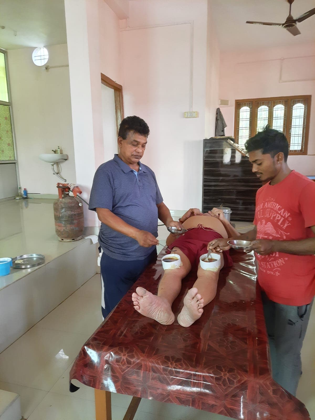 Janu Basti joint therapy by clinic staff